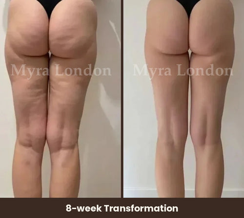 3D Anti-Cellulite Leggings